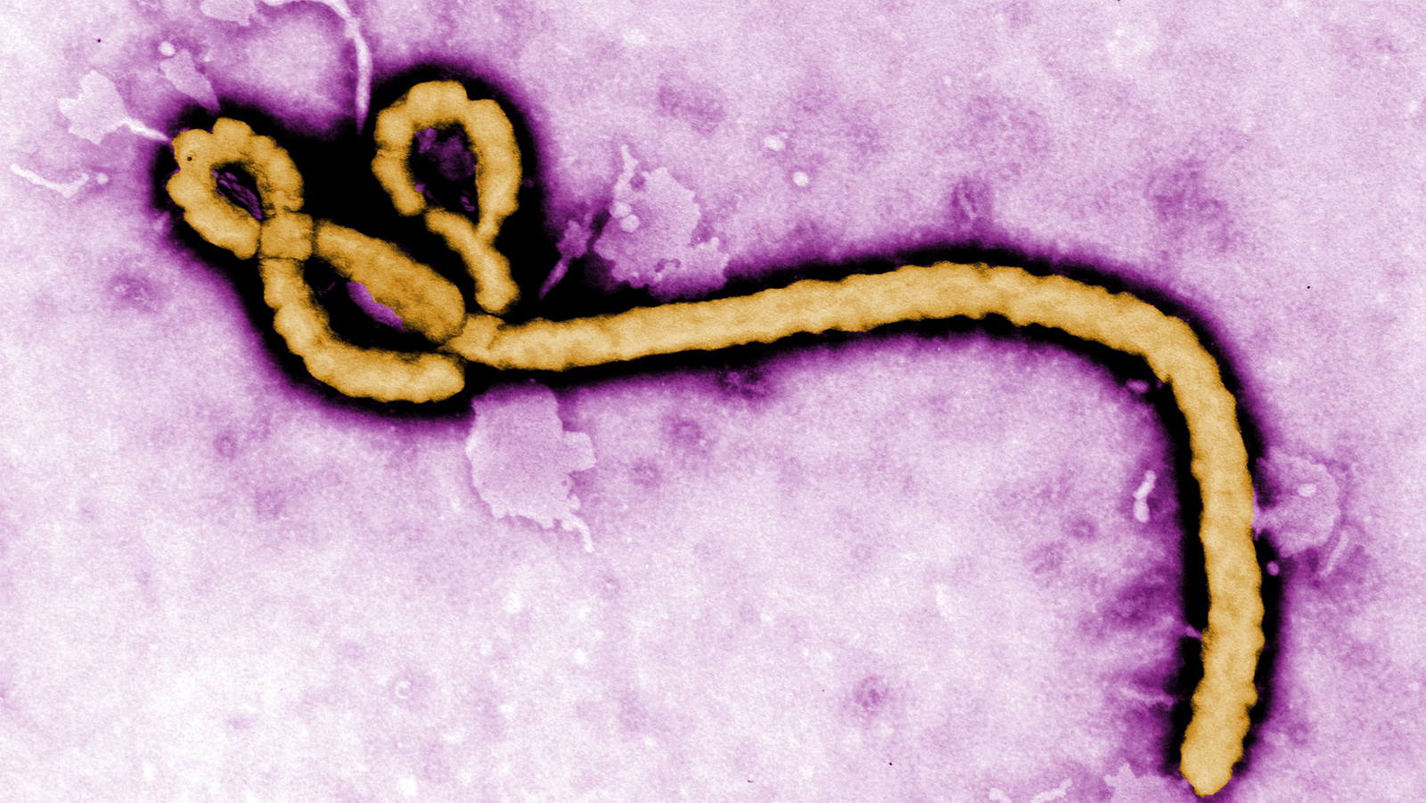 Ebola virus image